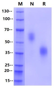 CD47 His Tag Protein, Human