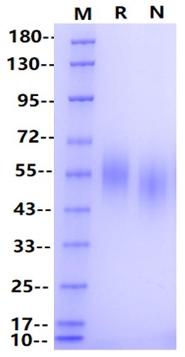 Nectin-1/PVRL1/CD111 His Tag Protein, Human