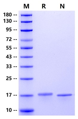 IL-21 Protein, Human