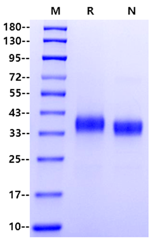 Spike RBD His Tag Protein, SARS-CoV-2(B.1.1.529/Omicron,N terminal)