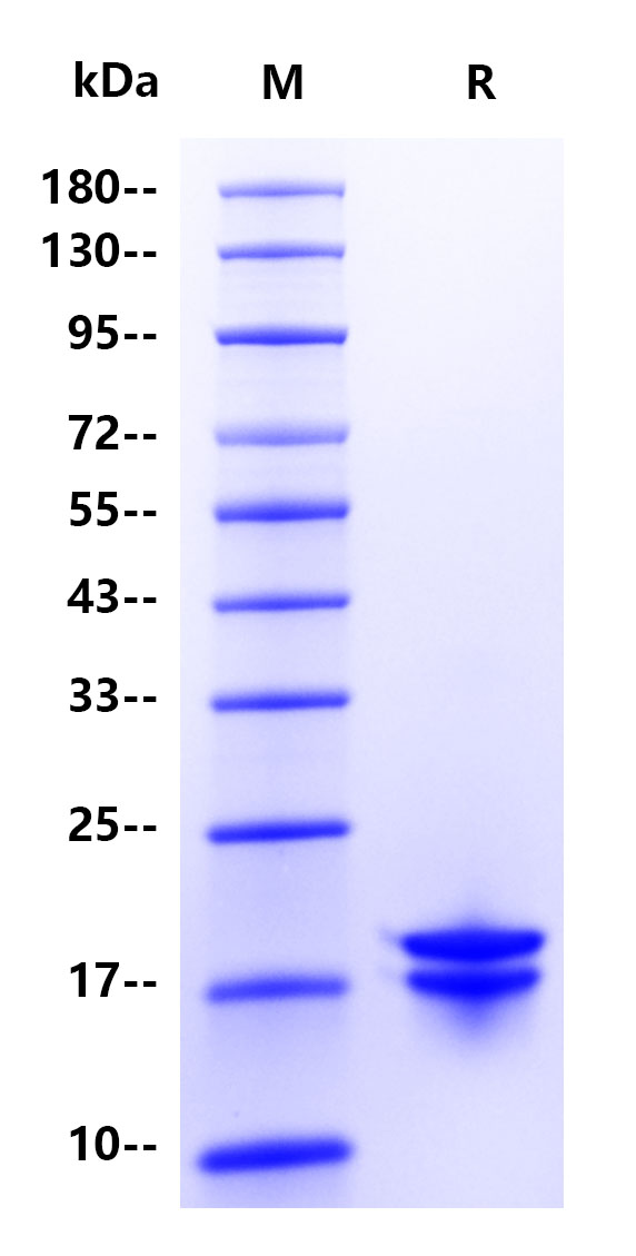 IL-2 Protein, Human