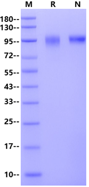 EGFR His Tag Protein, Human